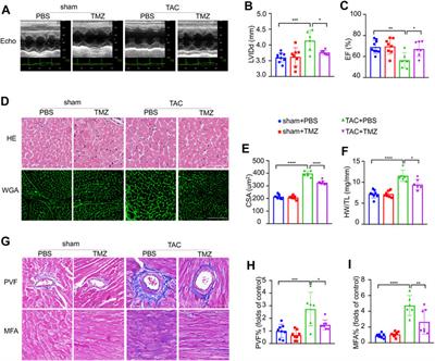 Trimetazidine Attenuates Heart Failure by Improving Myocardial Metabolism via AMPK